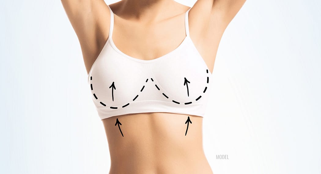 Do I Need A Breast Lift? The Pencil Test vs. The Pinch Test